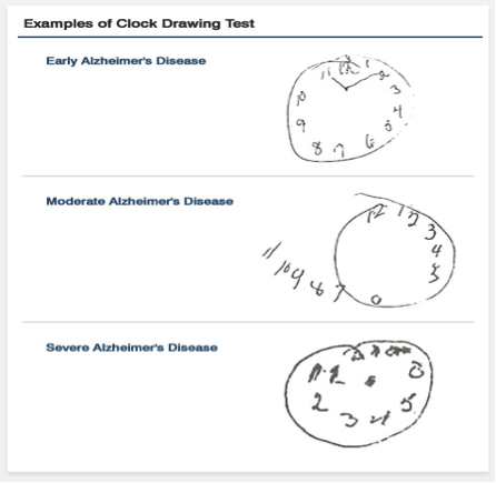 Clock-Drawing Test